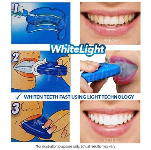 White Light Teeth Whitening Device - LED Light Technology - Ghar Baithe Professional Results